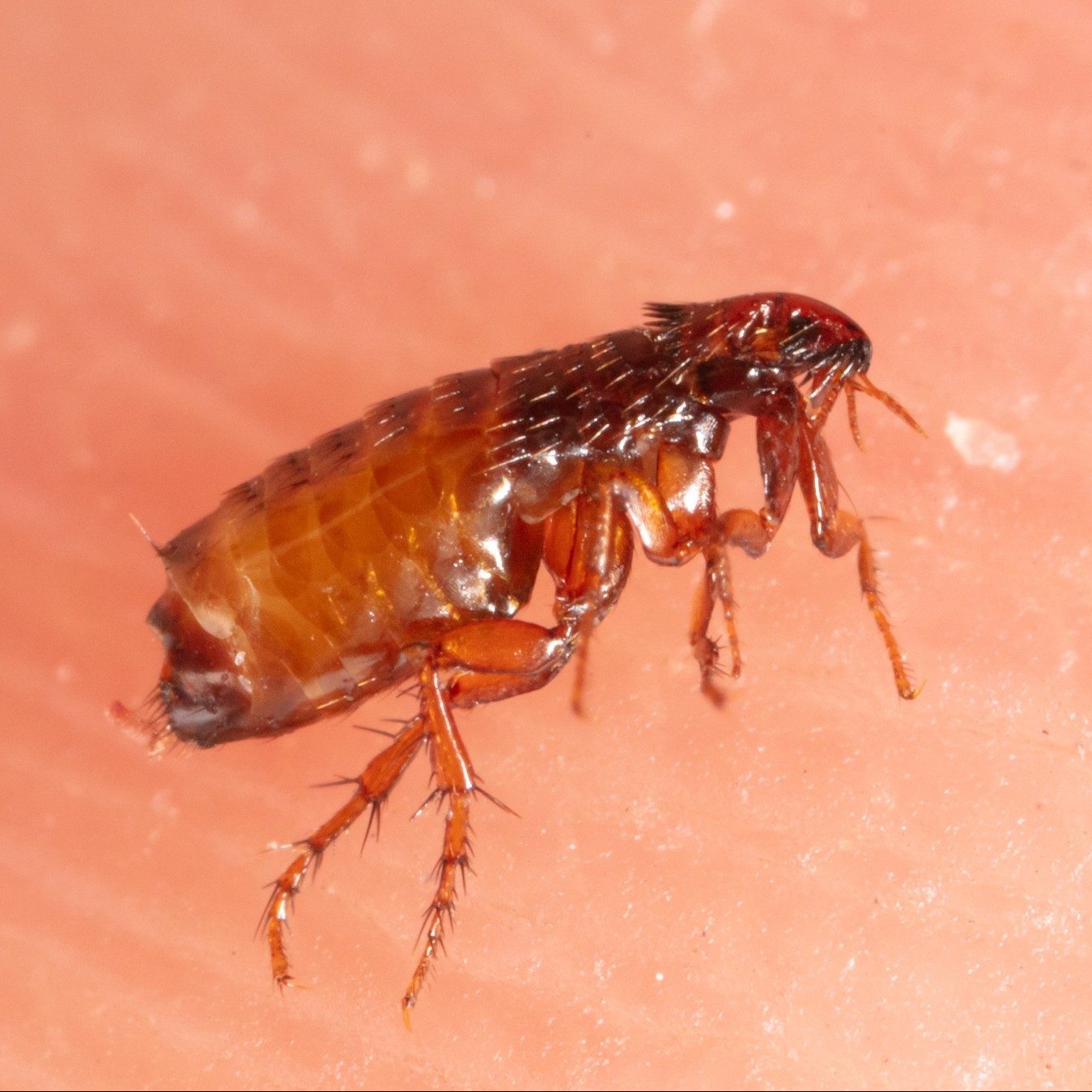 Flea,On,Human,Skin.,Macro